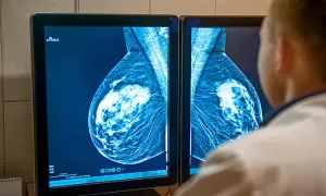 Người đàn ông bị ung thư vú